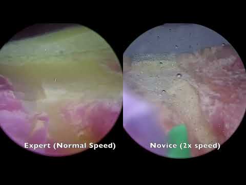 V02-01: Design and validation of a non-biohazardous Simulation Model for HoLEP