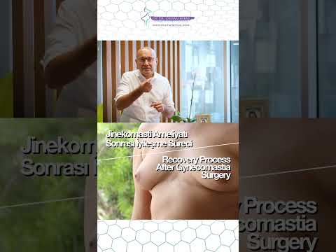 recovery-period-after-gynecomastia-surgery