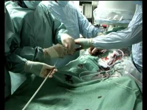 Mal di schiena mezzo Dolore alle articolazioni delle mani e le spalle a casa