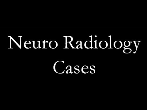 Case of infarction from acute to chronic.