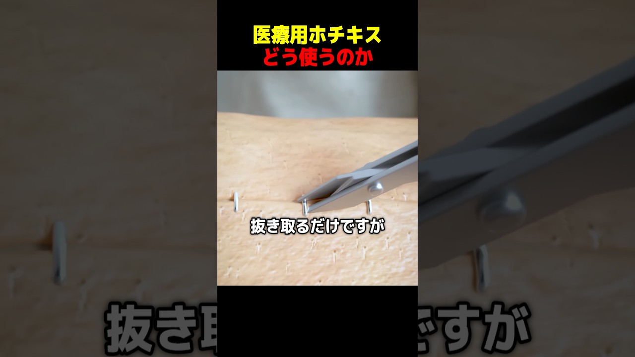 医療用ホチキスどう使うのか