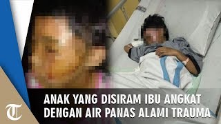 Anak yang Disiram Air Mendidih oleh Ibu Angkat Alami Trauma, Korban Ketakutan dan Menangis