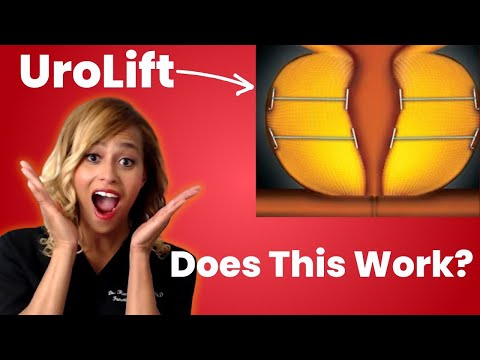 Urolift - What Your Doctor Hasn’t Told You About it 🧐