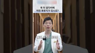 팔다리 뾰루지와 접촉 피부염, 원인에 맞는 관리
