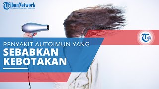 Alopecia Areata, Penyakit Autoimun di Mana Sistem Kekebalan Tubuh Menyerang Sel-sel Sehat