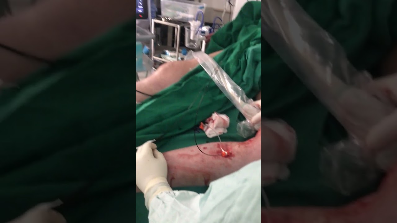 Ricardo Wagner Vasquez-25