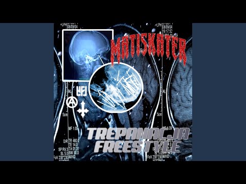 TREPANACJA FREESTYLE