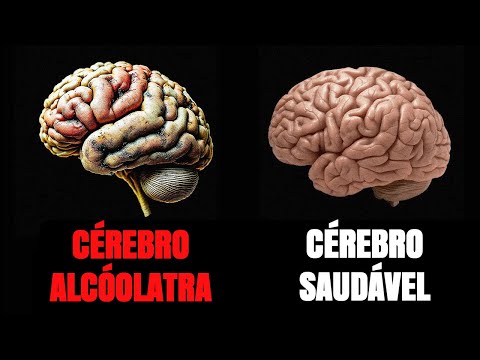 How alcohol affects the human brain (SCIENCE EXPLAINED)