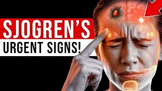 URGENT: 10 BAD SIGNS of Sjogren’s Syndrome - A Very Complex Autoimmune Disease