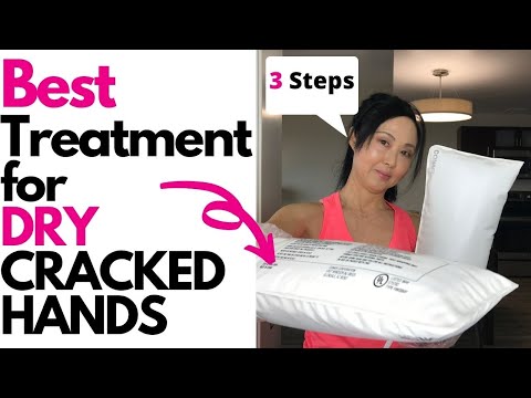 Best Treatment for DRY Cracked Hands #goseechristy #hiltohotels