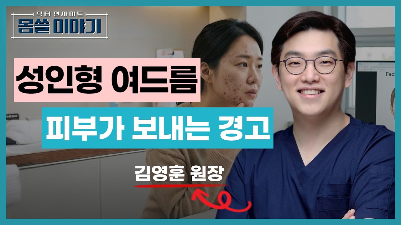 피부가 보내는 경고 성인형 여드름 관리하는 방법 [몸쓸이야기 15회]