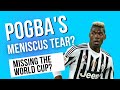 Paul Pogba Knee Injury - Meniscus Tear Explained