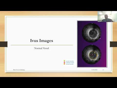 Basic Intravascular Ultrasound in Cardiology