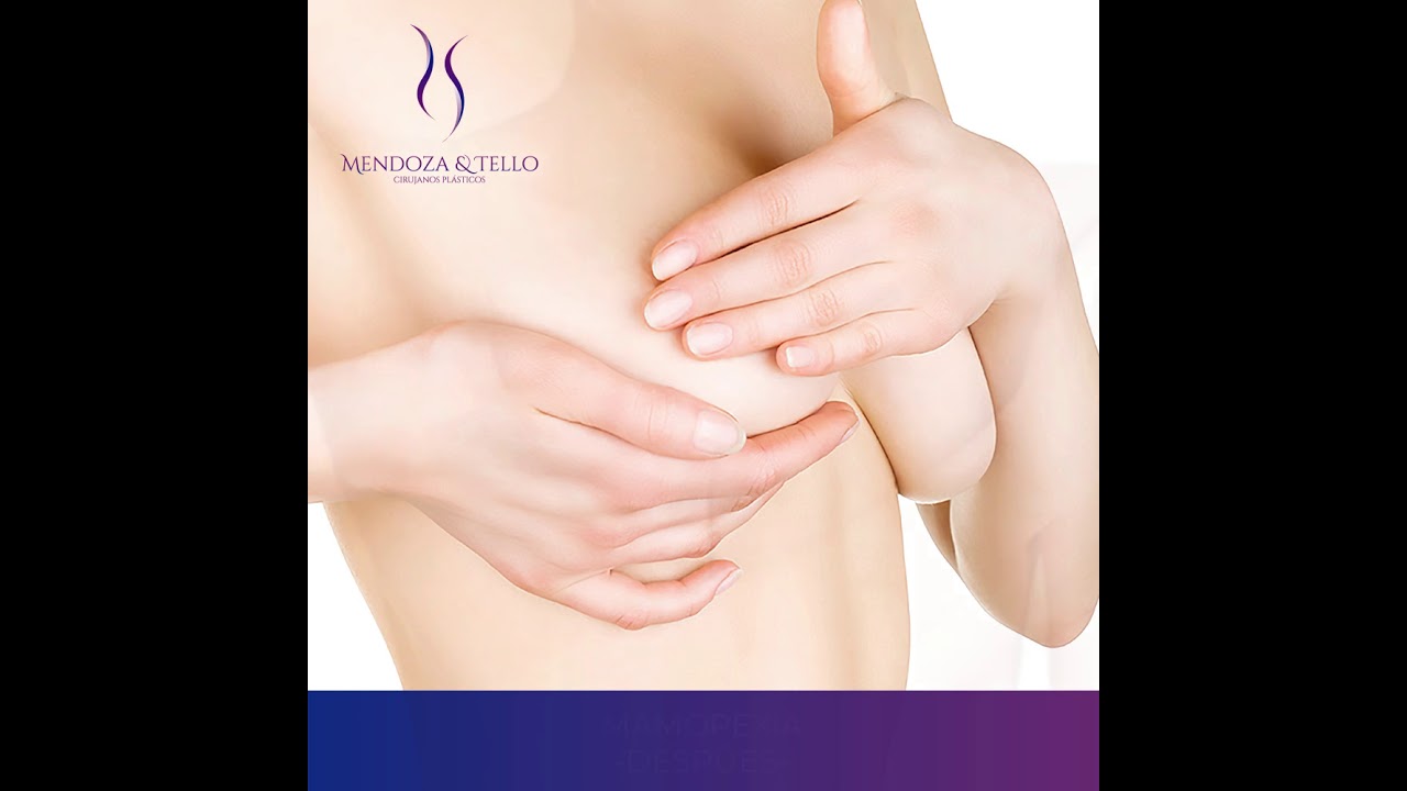 Alexander Mendoza-111