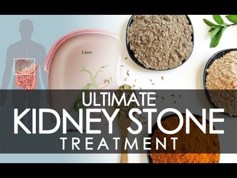 Micracle Treatment of  Kidney Stone & Gall Bladder Stone (पथरी) Through Homeopathy & Ayurveda