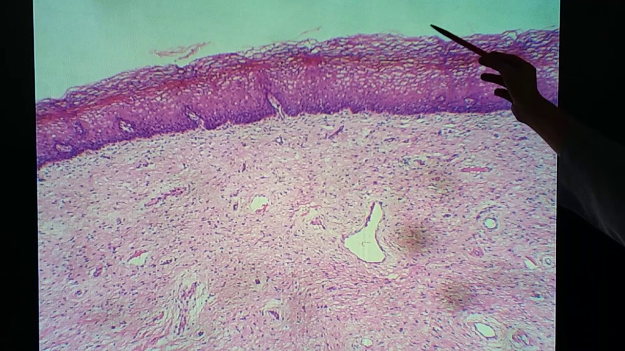 Histologia da  vagina