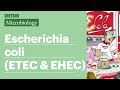 E Coli ETEC EHEC Lesson Types Factors Part 1 Sketchy Medical USMLE Step 1