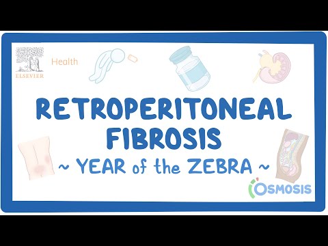 Achalasia Year of the Zebra