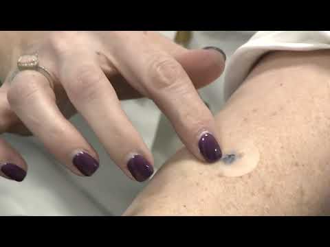 dermal skin tag patch instructions