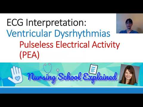 Pulseless Electrical Activity (PEA)