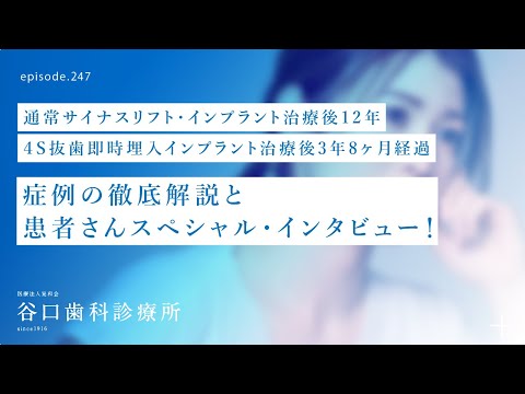 第247話  インプラント治療後12年経過患者さんスペシャル・インタビュー4S抜歯即時埋入インプラント治療後3年8ヶ月❗️、サイナスリフト‼️