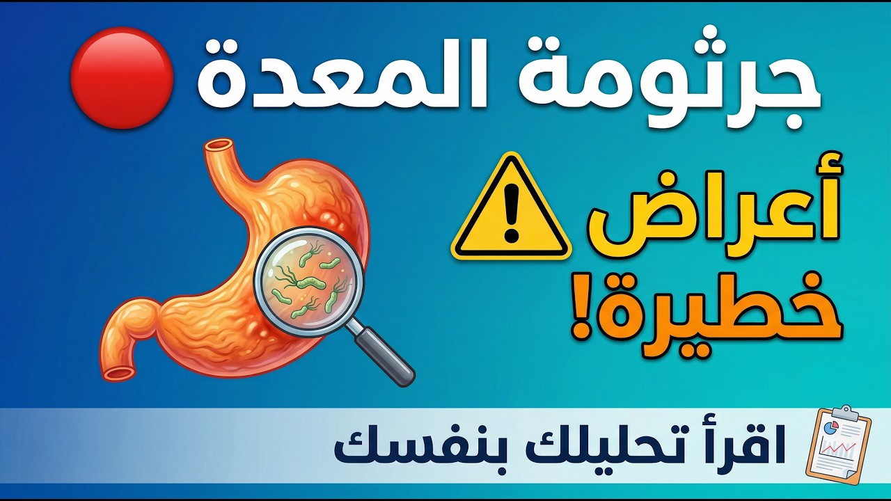 جرثومة المعدة واعراضها وقراءة التحليل