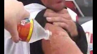 preview picture of video 'KC Chiefs fan get branded!'
