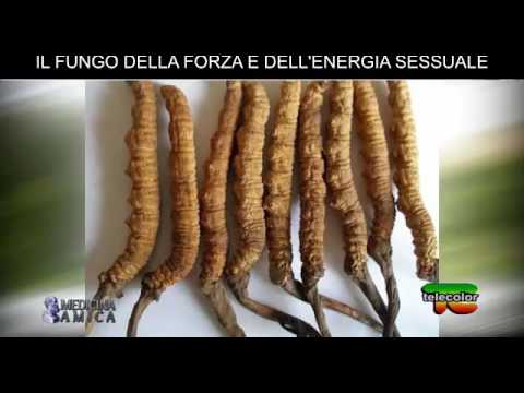 Crepitus polso Cosa fare se una spina dorsale dolorante in osteocondrosi
