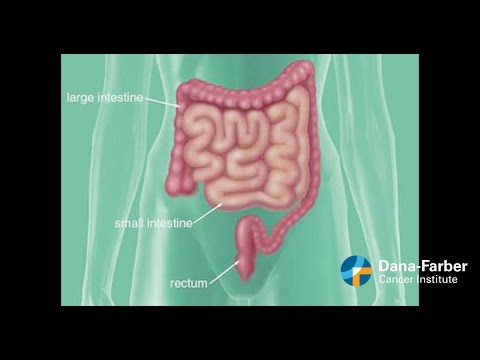 Colon v. Rectal Cancer: What you need to know