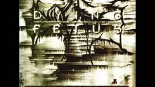 Dying fetus - vomiting the fetal embryo (audio)