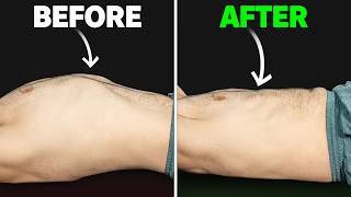 STOP Doing This if You Have Rib Flare