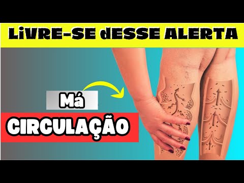 Confira 9 Dicas Essenciais Para MELHORAR a CIRCULAÇÃO SANGUINEA e TER Mais SAÚDE