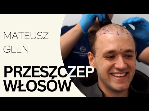 Piotr  Turkowski-52