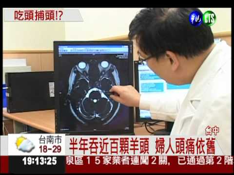 吃頭補頭? 婦吞百顆羊頭治頭痛