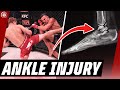 Ankle INJURY ? Brent Primus vs Michael Chandler | Bellator MMA