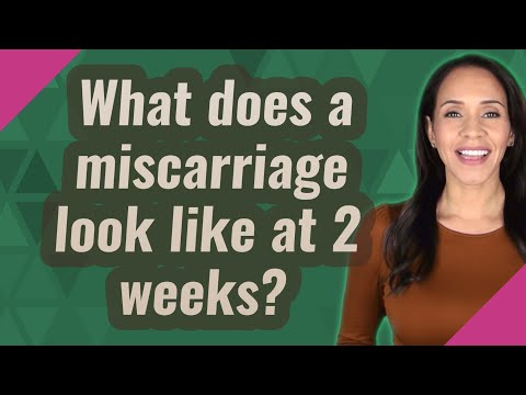 2 Weeks Miscarriage Images