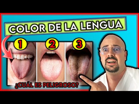 Lo Que El Color De Tu Lengua Revela Sobre Tu Salud