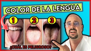 ¿Qué SIGNIFICA el COLOR de tu LENGUA || ¿Cuál INDICA enfermedad GRAVE