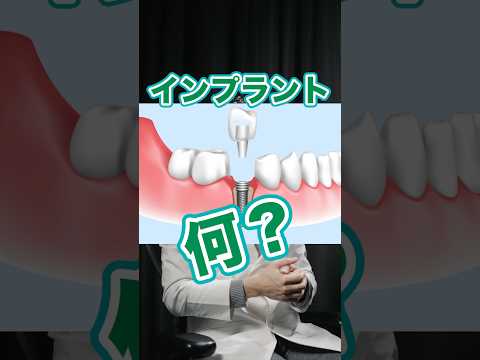 法学科 インプラントって何？小学生でもわかる解説！