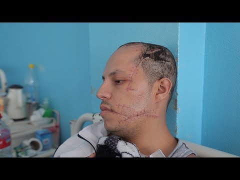 عصابة إجرامية تعتدي بشكل وحشي على شاب بمدينة القنيطرة ليلة عيد الأضحى