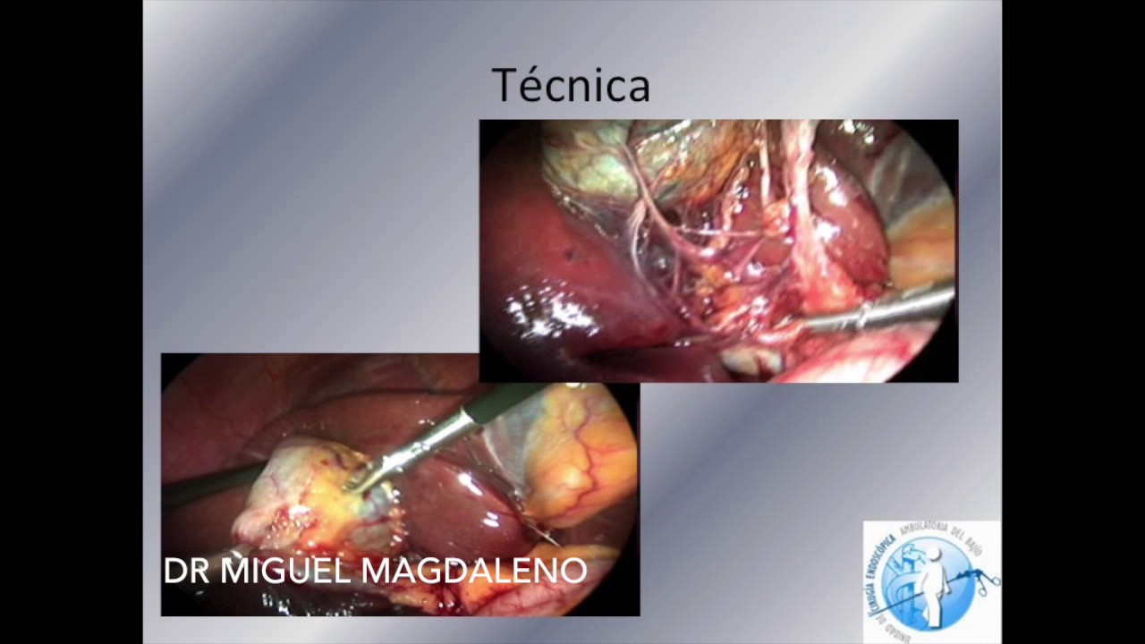 Miguel Magdaleno Garcia-11