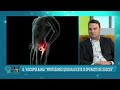Control Medical 24 Video thumbnail