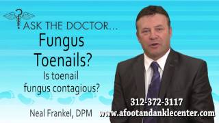 preview picture of video 'Is Toenail Fungus Contagious? Chicago, Lincolnwood, Oak Brook, IL - Podiatrist Neal Frankel'