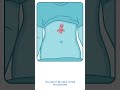 Assessment Clips Abdomen