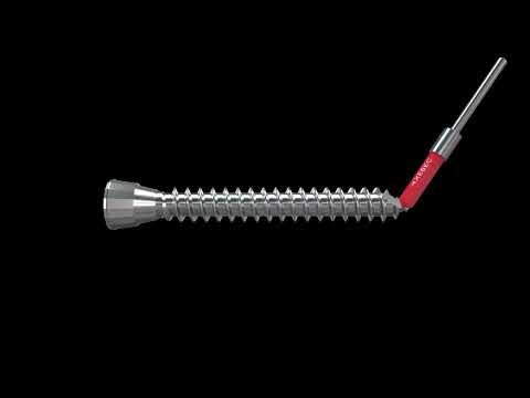 CNC deburring of osteosynthesis screw