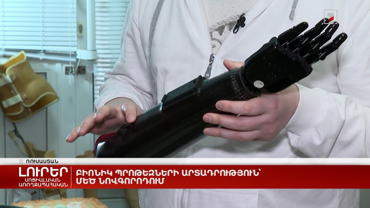 Բիոնիկ պրոթեզների արտադրություն՝ Մեծ Նովգորոդում