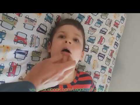 EFEITO DO CBD (Maconha) em crianças com epilepsia