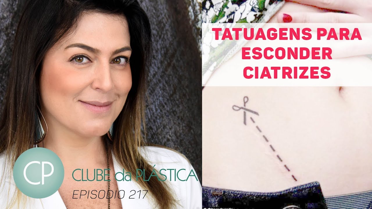Clube da Plástica: Tatuagens para esconder cicatrizes - cirurgia plástica