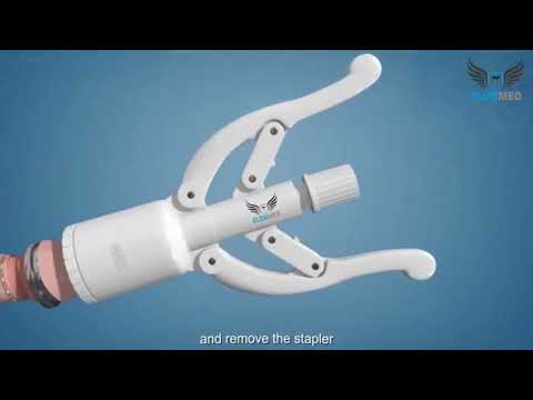 Clonmed disposable circumcision stapler, child