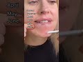What Happened After I Shaved My Face For 1 Year Shorts Hairremoval Dermaplaning Skincare